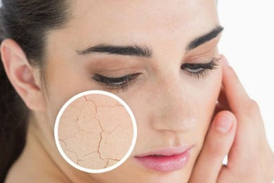 Cách Chăm Sóc Da Trong Giai Đoạn Chuyển Mùa